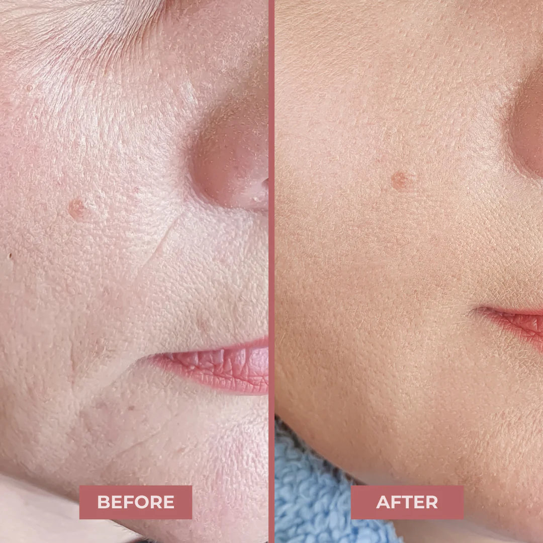 Salmon PDRN Pocket Balm For Fine Lines & Wrinkles