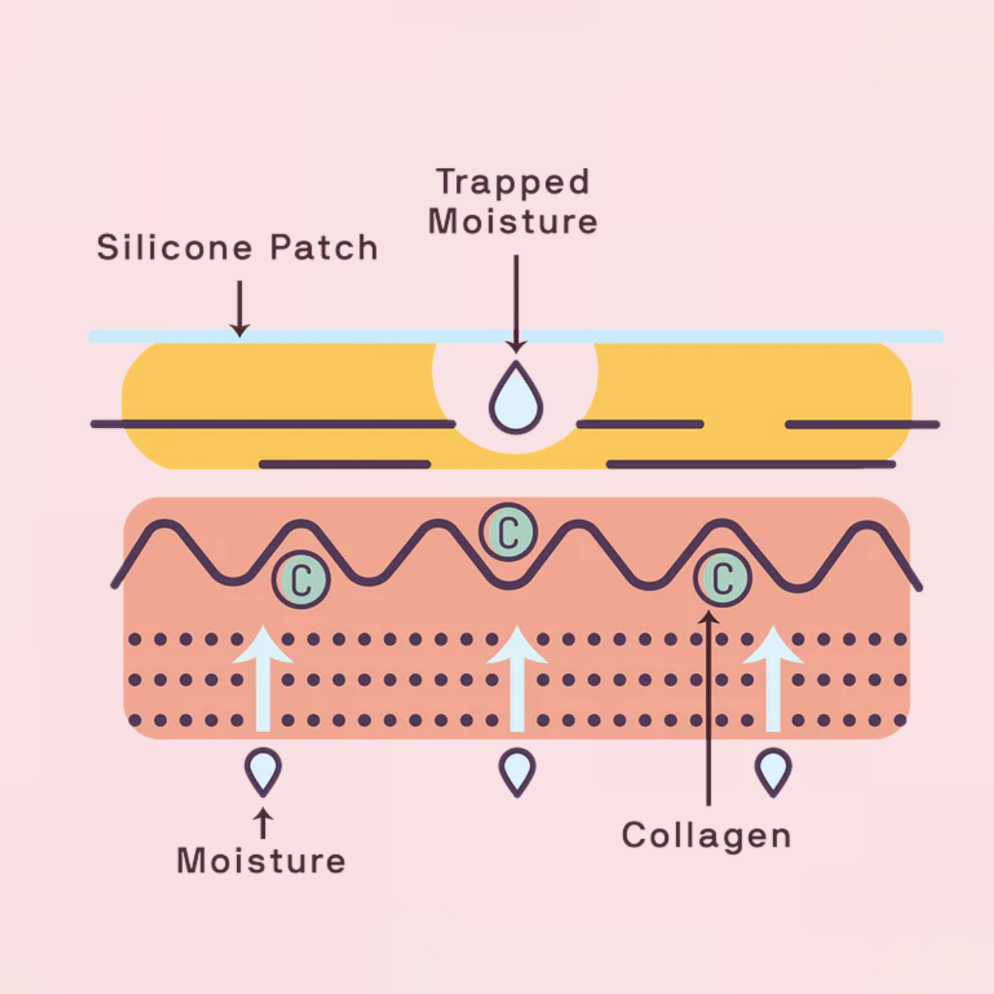 Silicone StretchMark Pack™