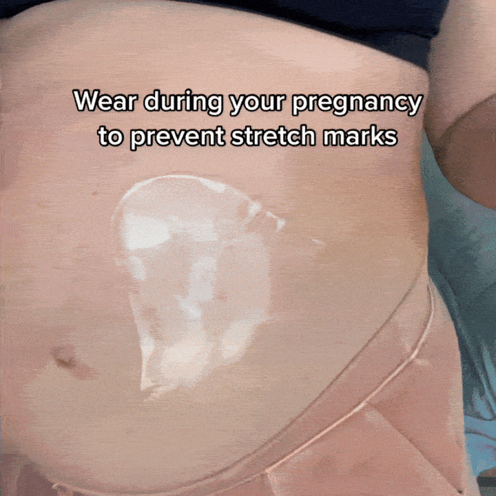 Silicone StretchMark Pack