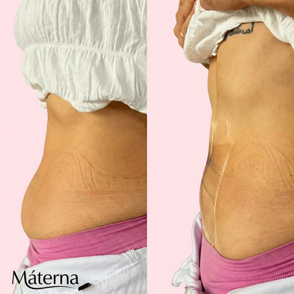 Instant Tummy Tuck