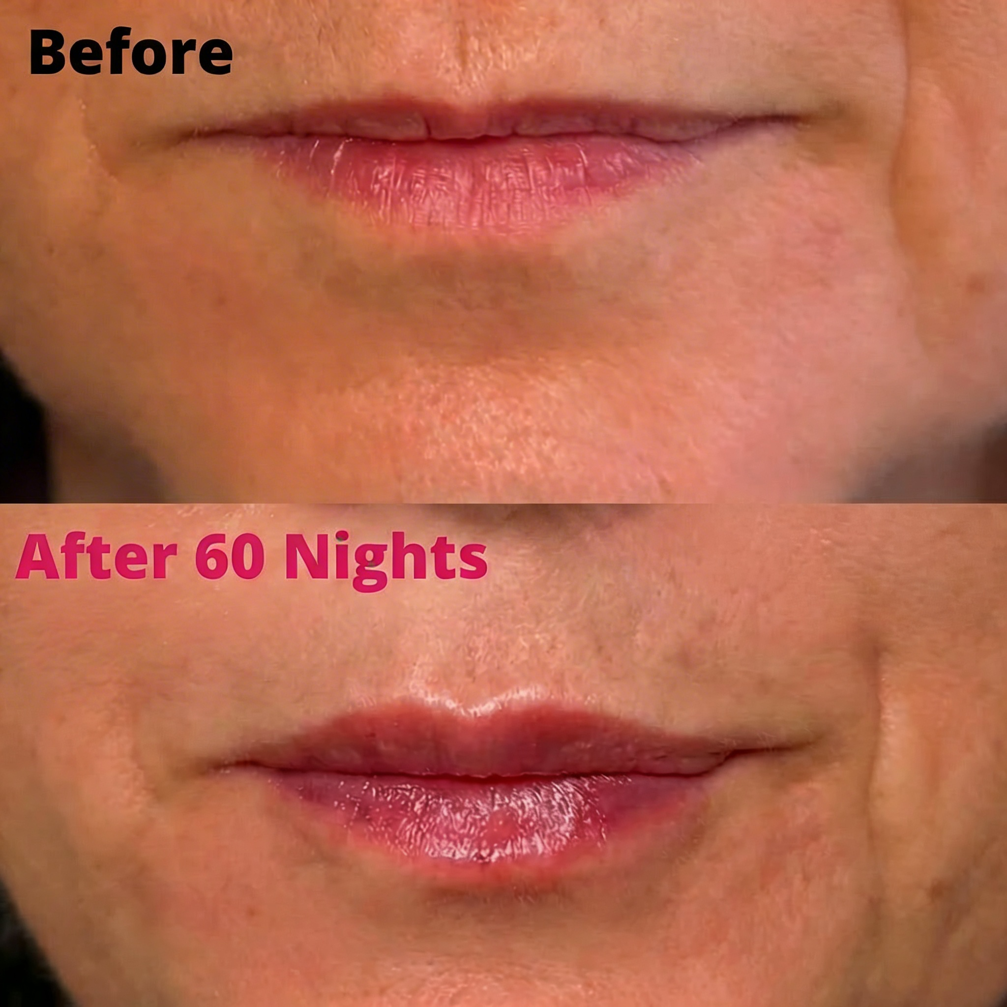 Collagen Lip Tape